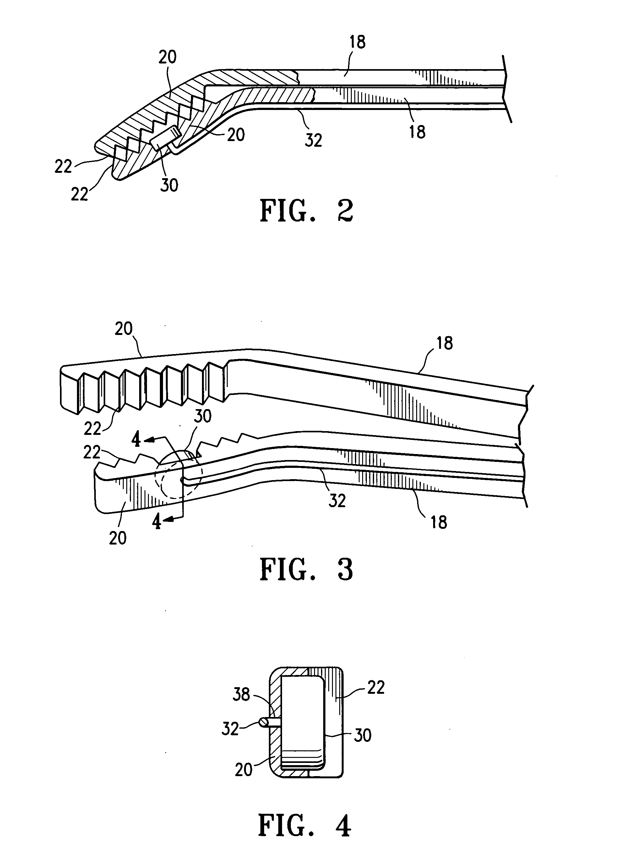 Method and device for treating adenomyosis and endometriosis