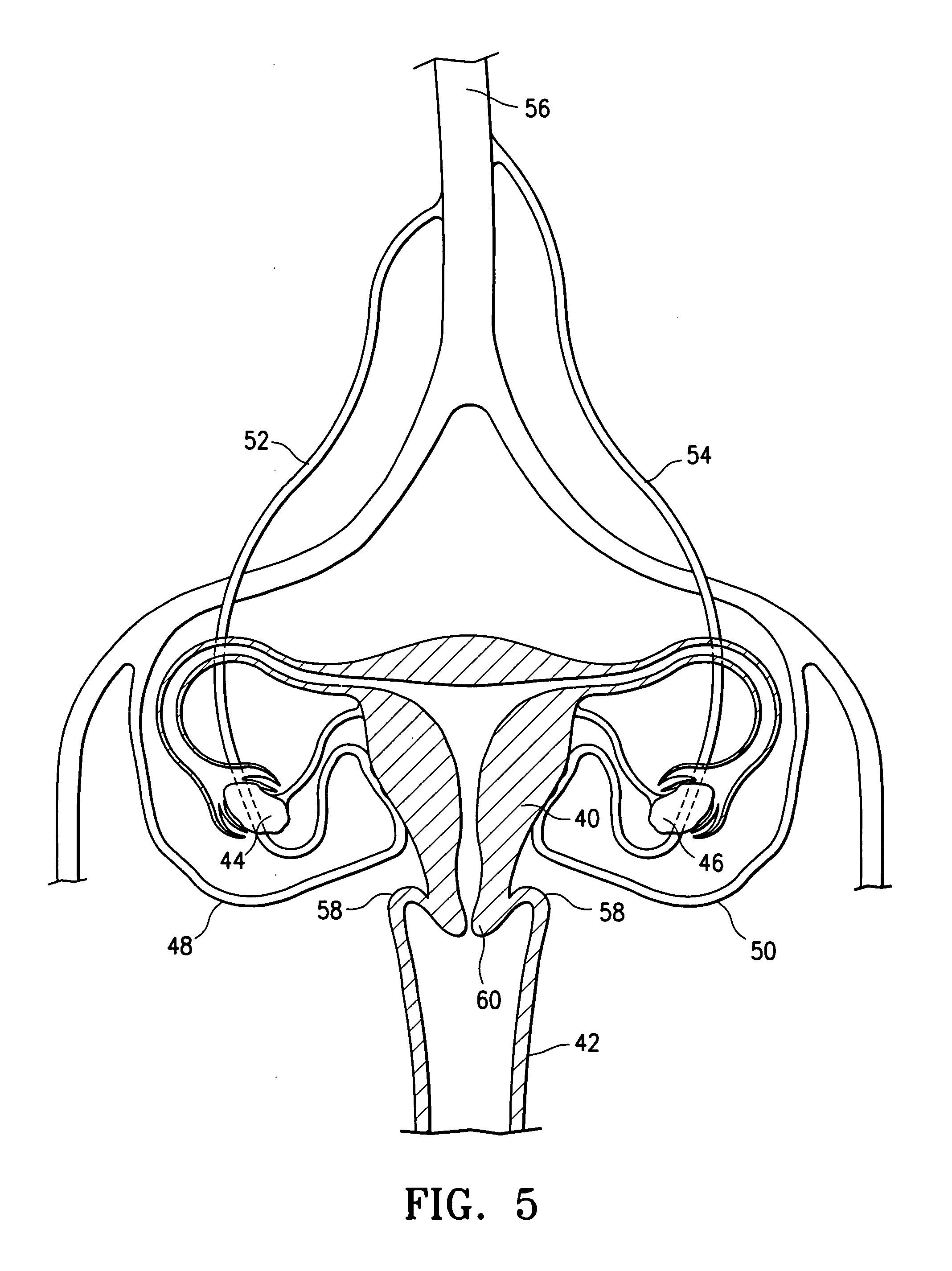 Method and device for treating adenomyosis and endometriosis