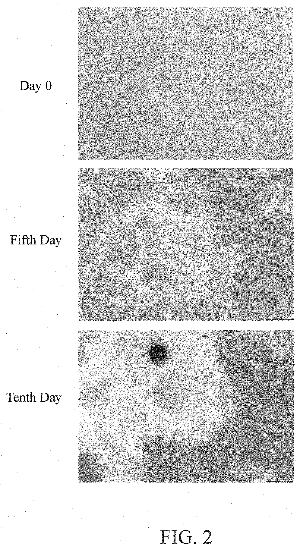 Use of n-butylidenephthalide in dopaminergic progenitor cell transplantation
