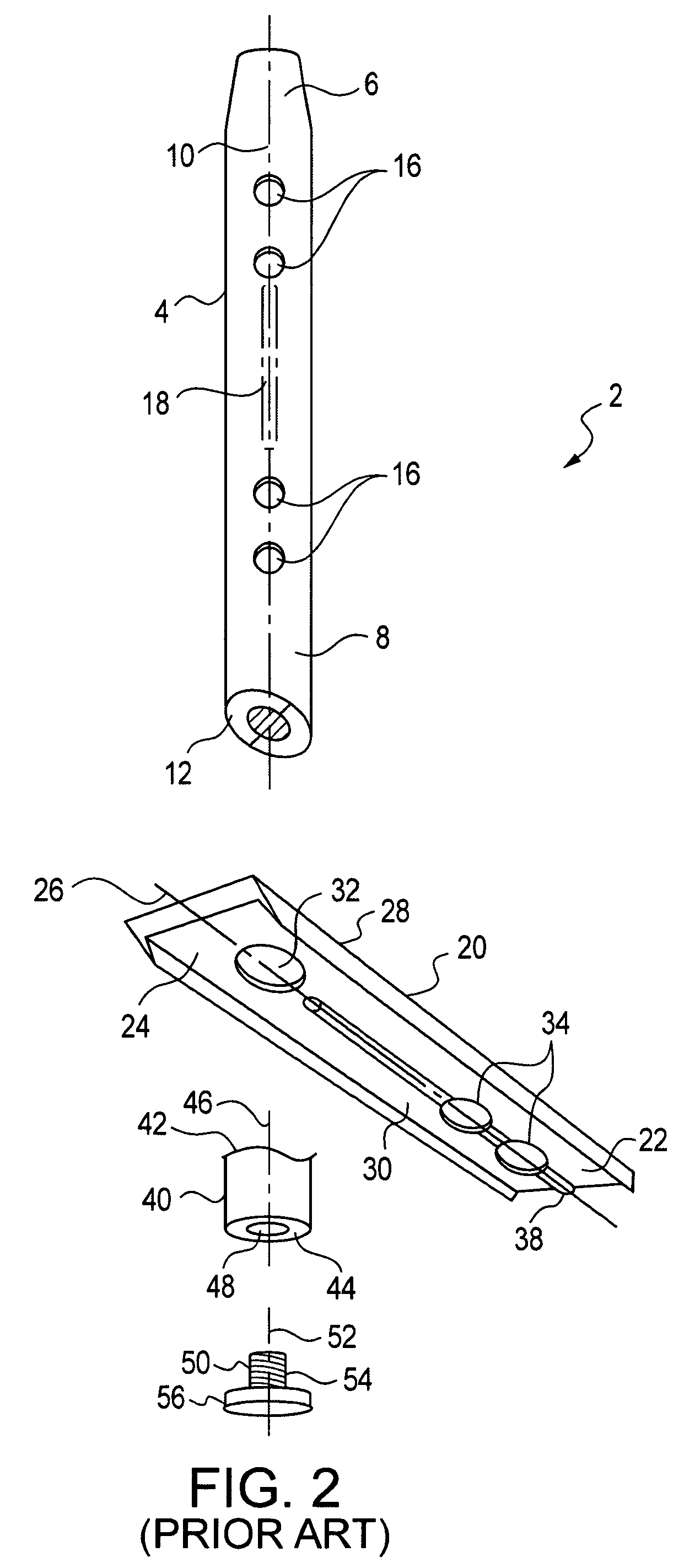 Modular, blade-rod, intramedullary fixation device