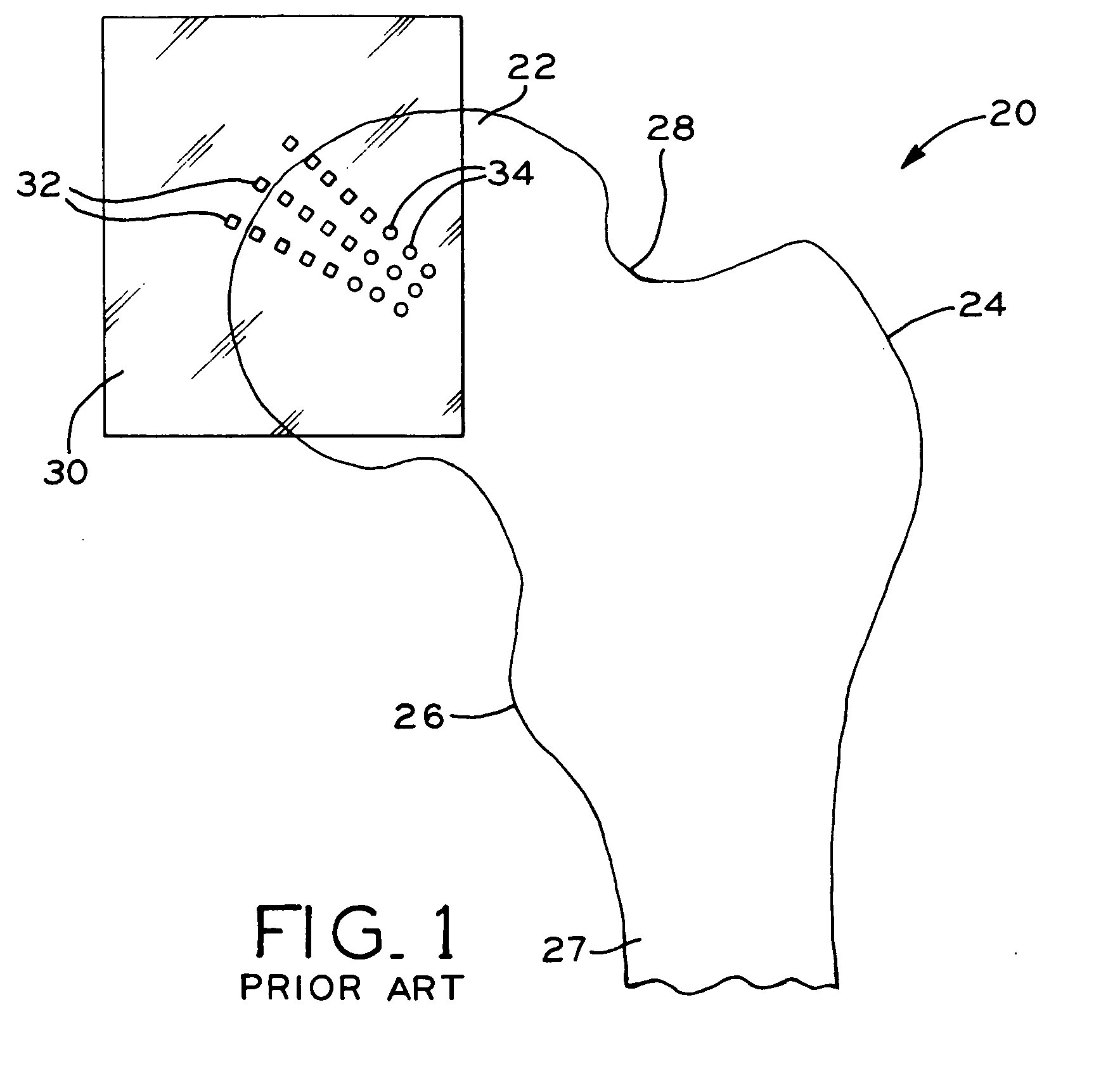 Method for selecting modular implant components