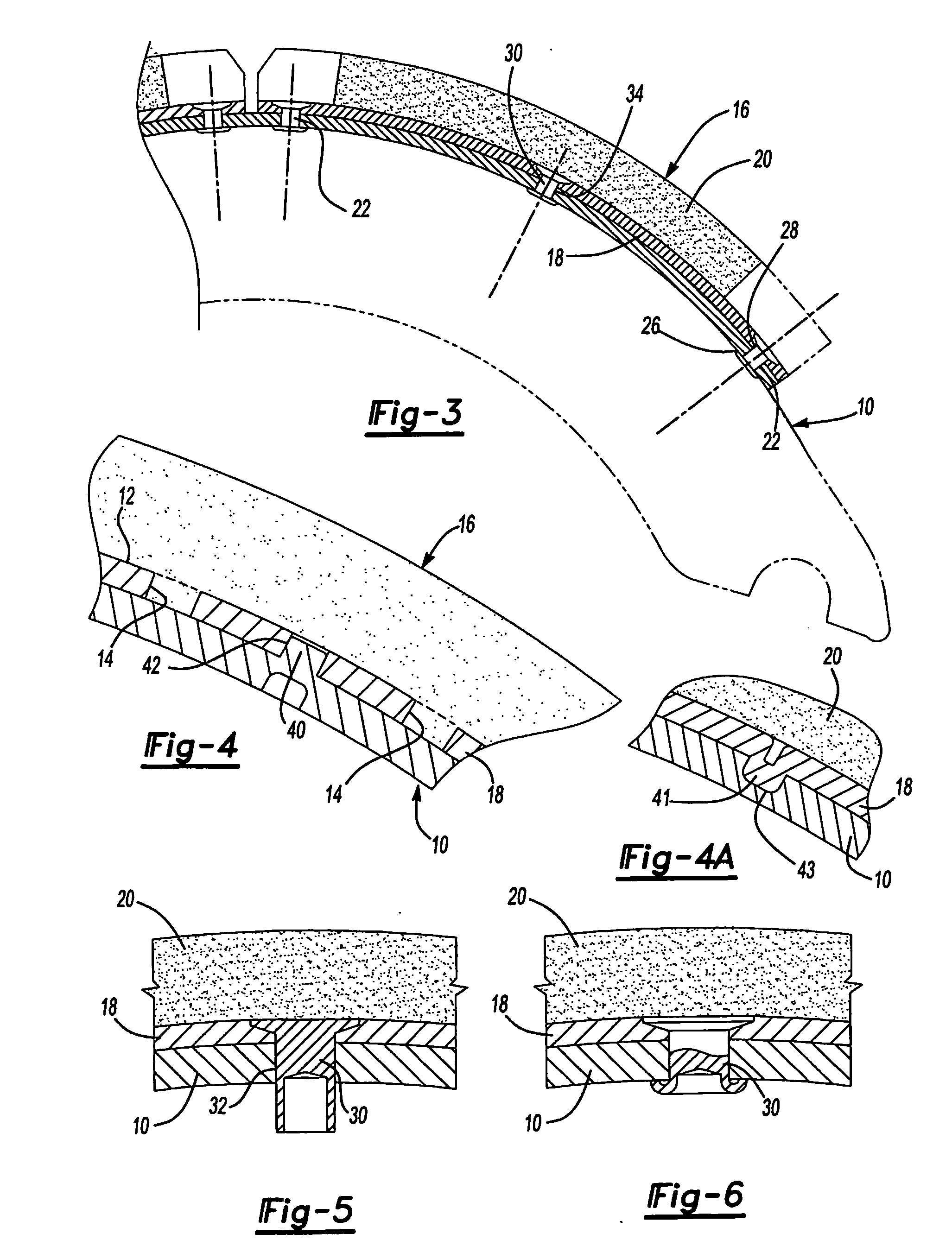 Brake shoe and brake lining blocks with keyed connection