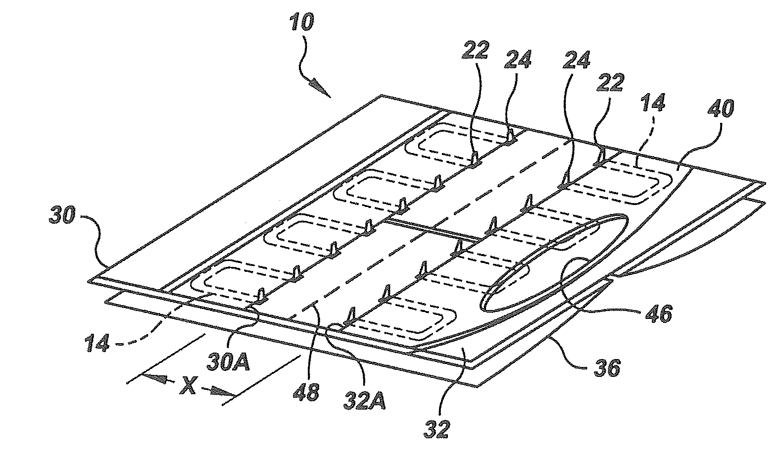 Adjustable non-invasive wound closure system