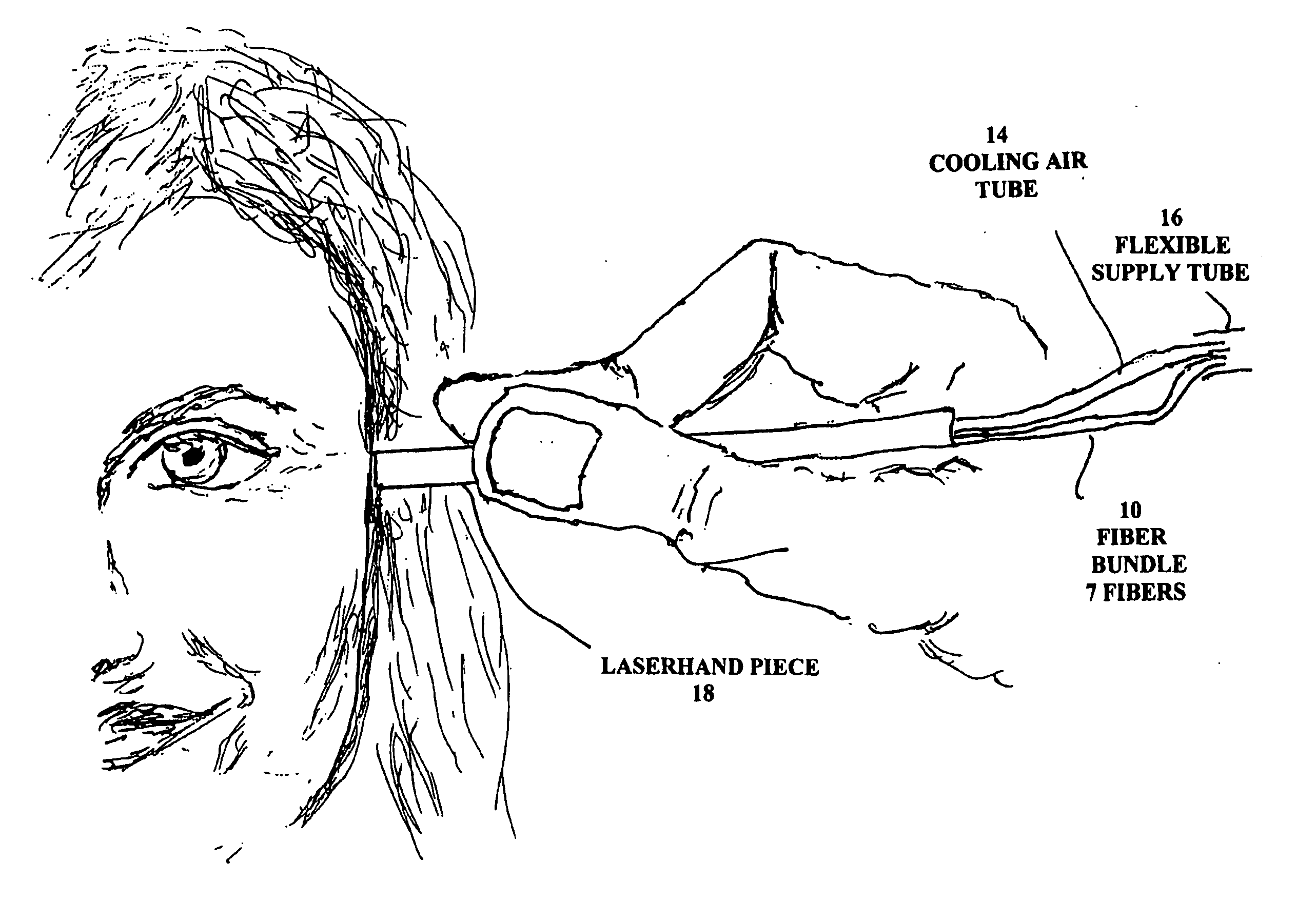 Skin treatement system with time modulated laser pulses