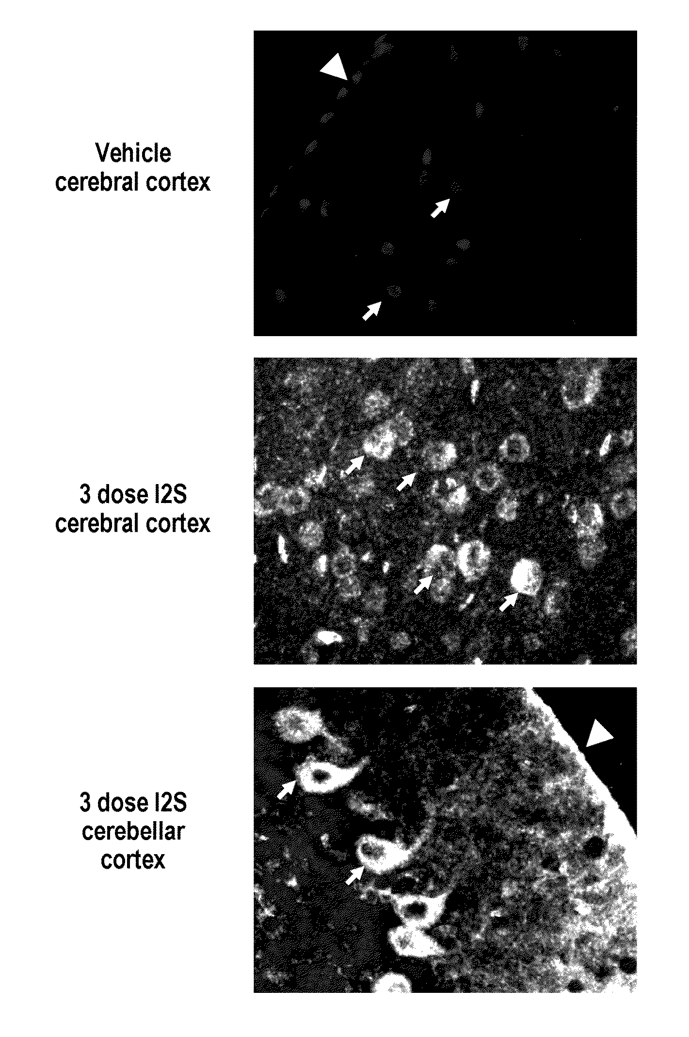 Methods and compositions for CNS delivery of iduronate-2-sulfatase