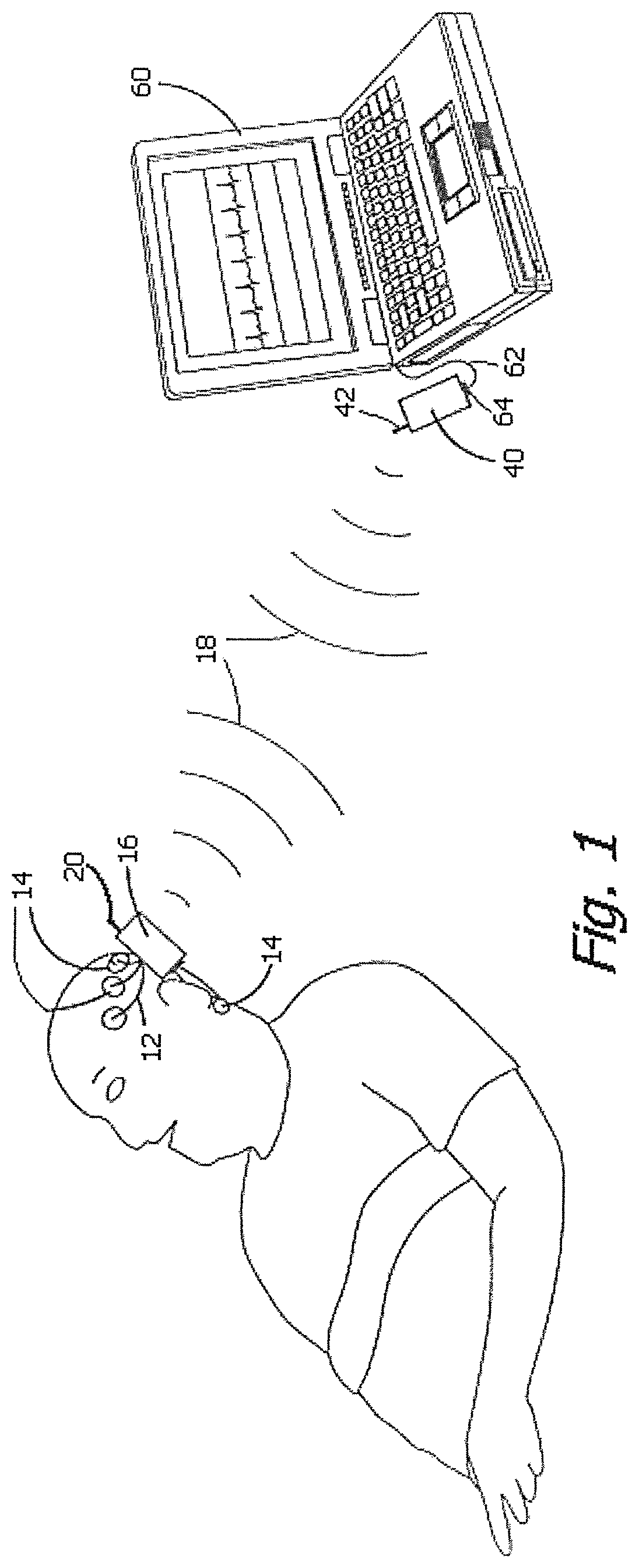 Wireless data acquisition system with novel features