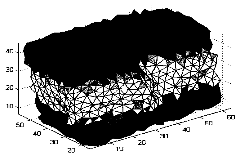 Prediction method of choroidal neovascularization based on constitutive model and finite element method