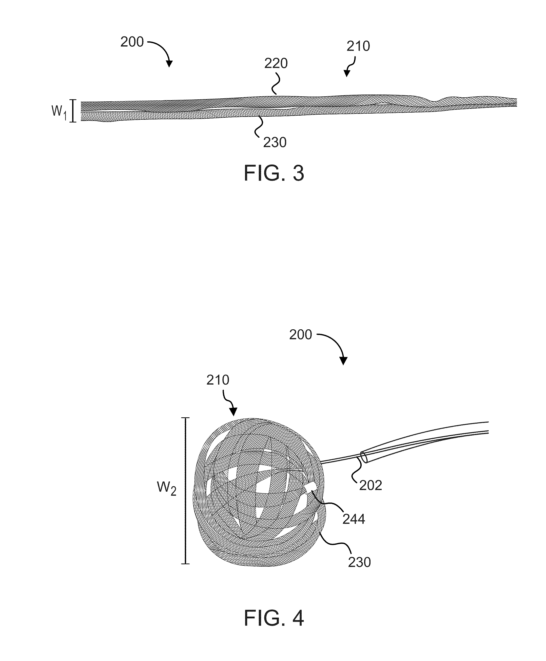 Devices and methods for the treatment of vascular defects