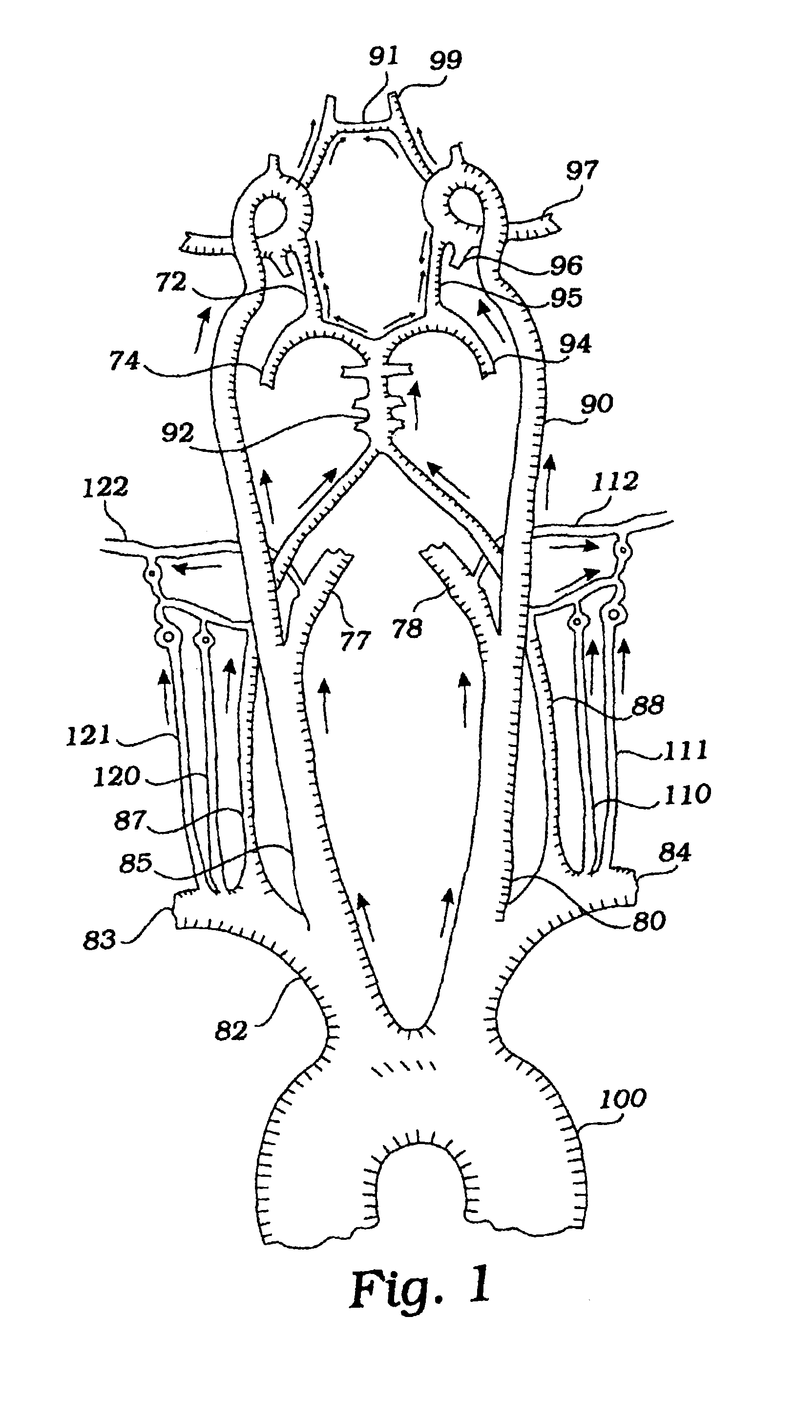 Devices and methods for preventing distal embolization from the vertebrobasilar artery using flow reversal