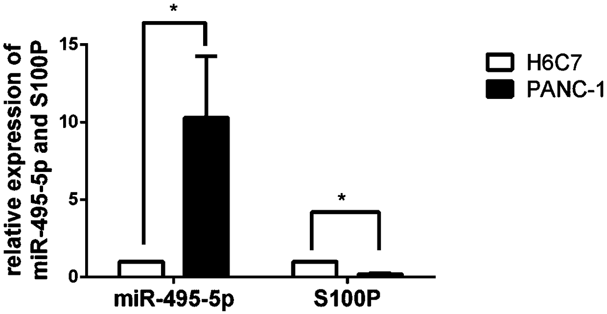 Application of miR-495-5p in preparation of products for diagnosis, prognosis, prevention or treatment of pancreatic cancer