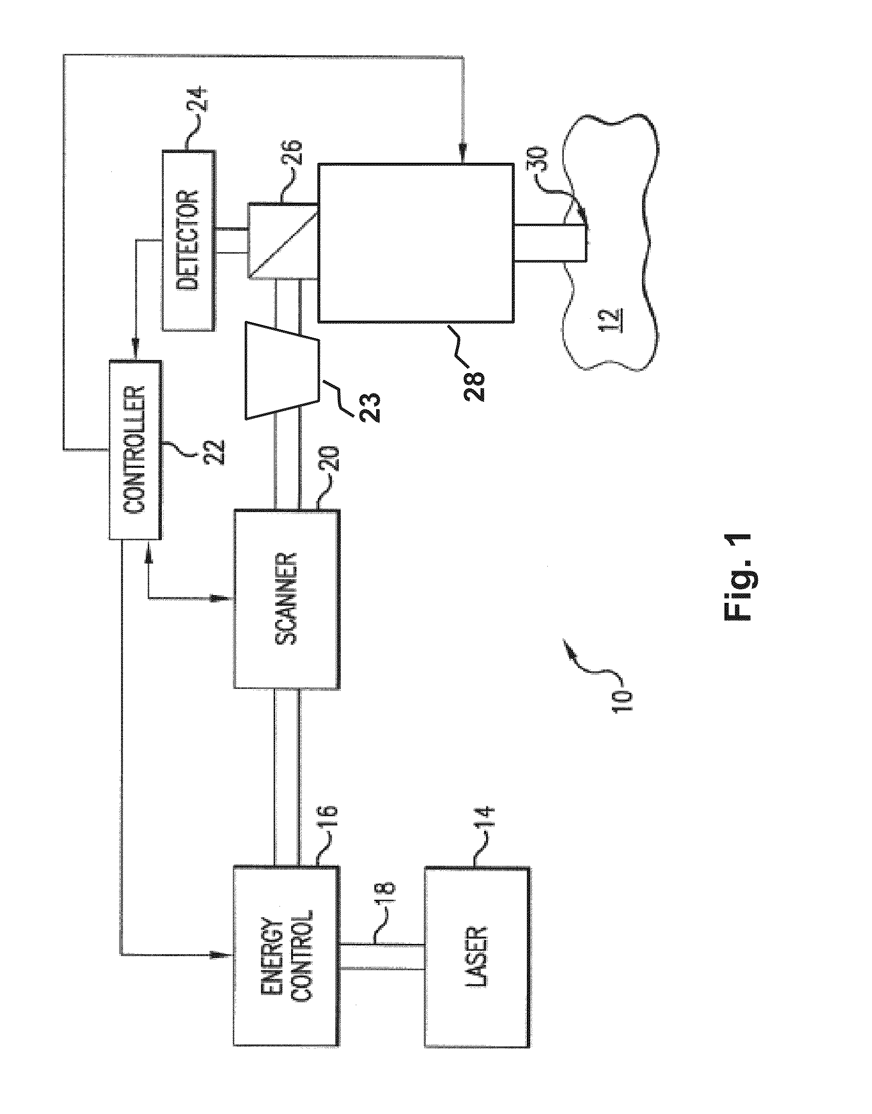 Systems and methods for synchronized three-dimensional laser incisions