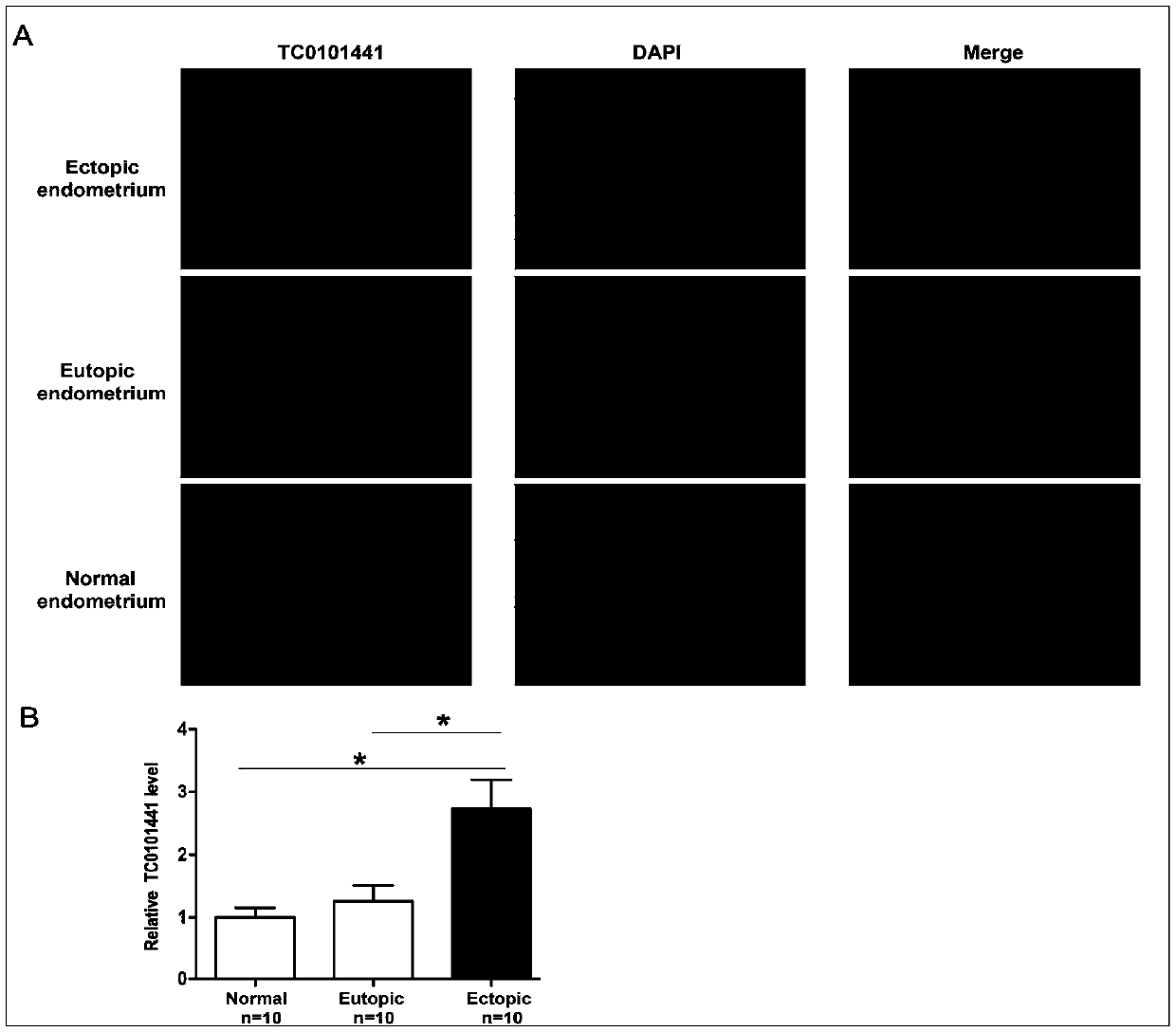 Usage of circulating exosome long-chain non-coding RNA-TC0101441 as marker for diagnosing endometriosis