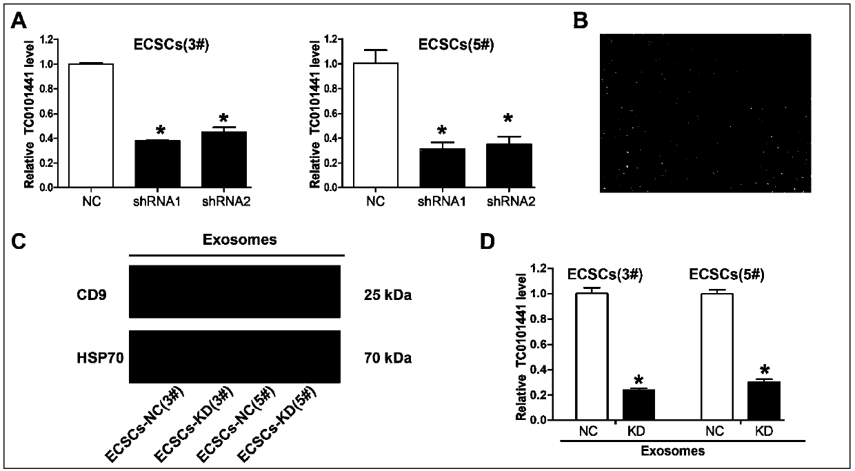 Usage of circulating exosome long-chain non-coding RNA-TC0101441 as marker for diagnosing endometriosis