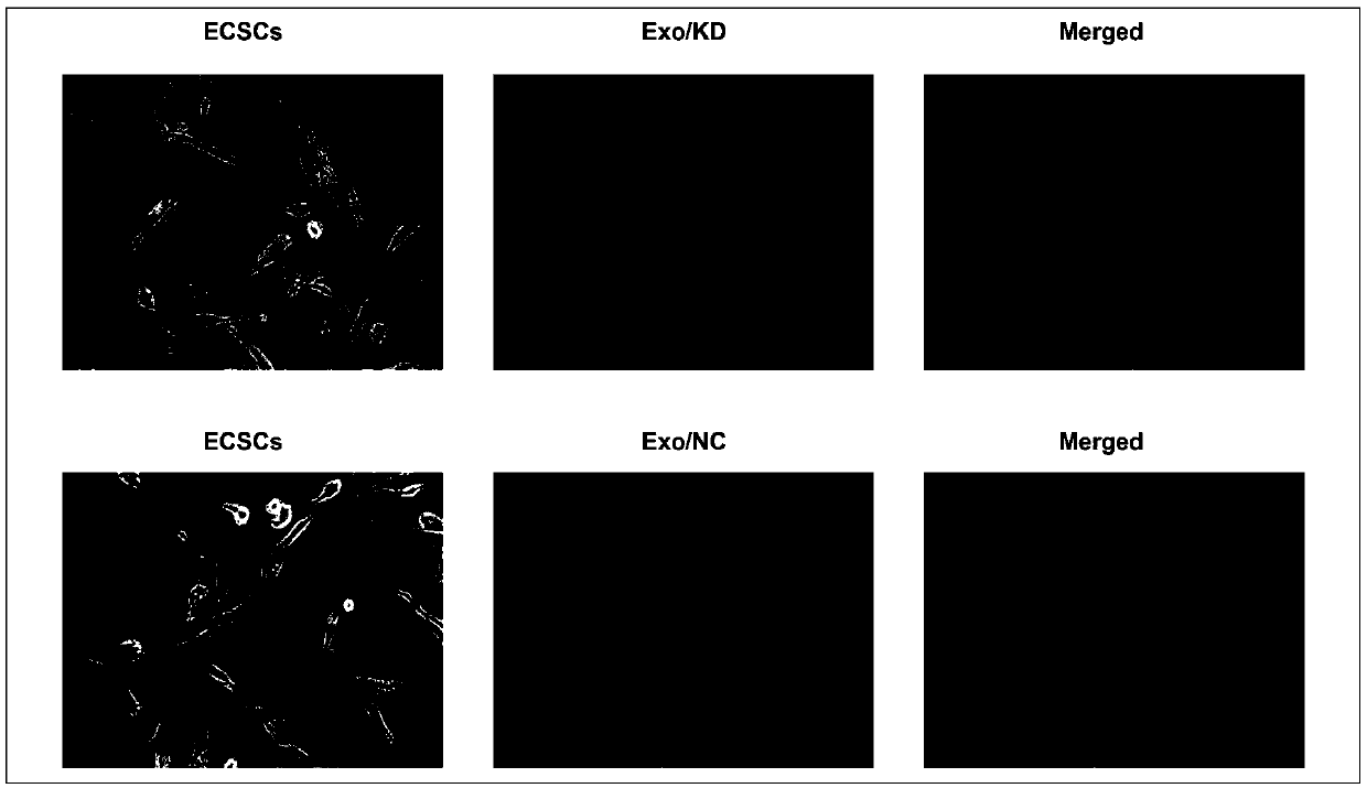 Usage of circulating exosome long-chain non-coding RNA-TC0101441 as marker for diagnosing endometriosis