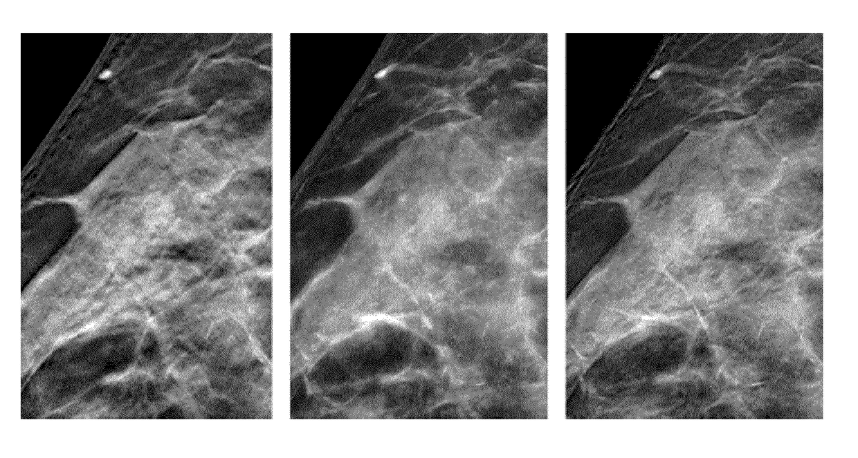 Method for generation of synthetic mammograms from tomosynthesis data