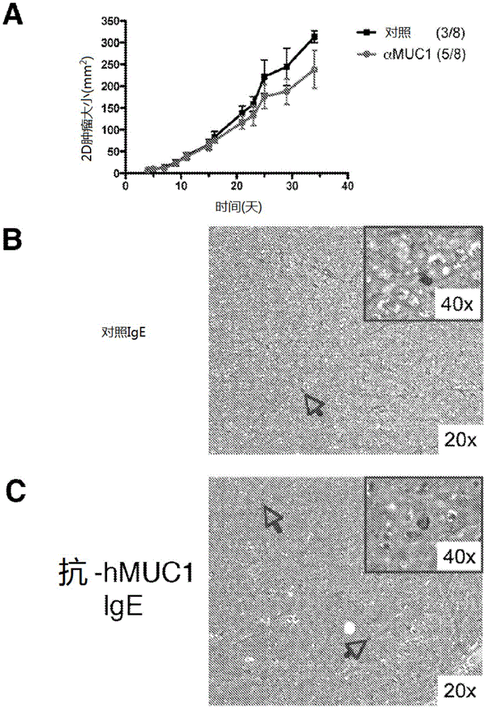 IgE antibodies for the inhibition of tumor metastasis