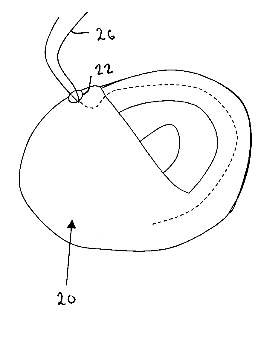 Gastro-intestinal device and method for treating addiction