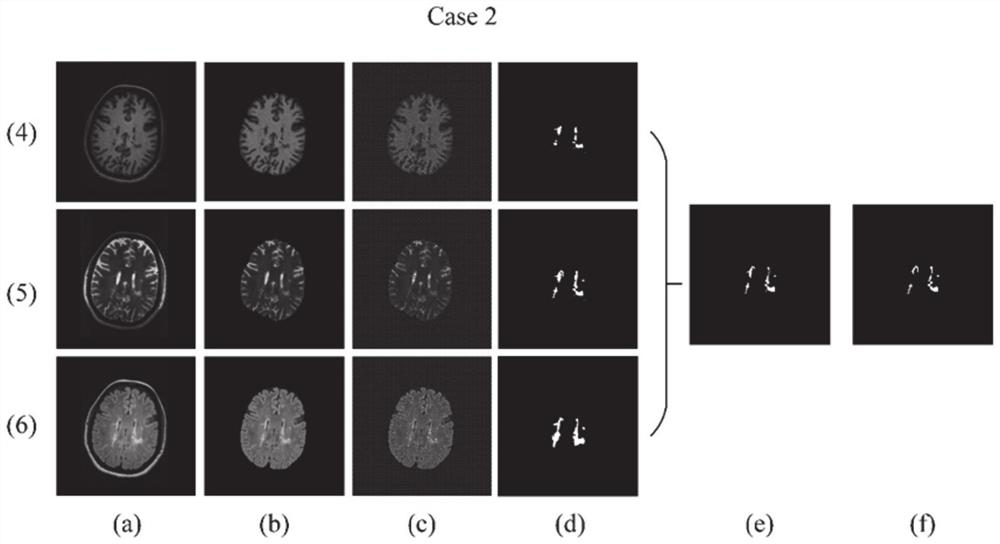 Image segmentation method and system based on fuzzy C-means and probability label fusion