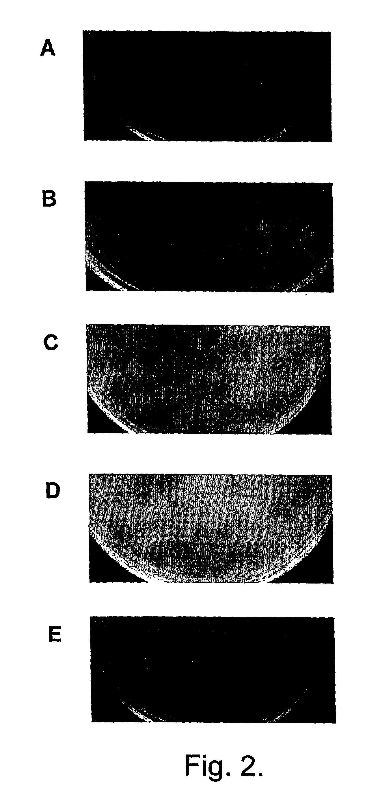 Bacteriophage-containing therapeutic agents