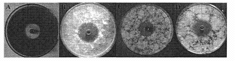 Preparation and use of lilac grey streptomycete and active product thereof