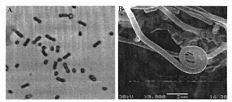 Preparation and use of lilac grey streptomycete and active product thereof