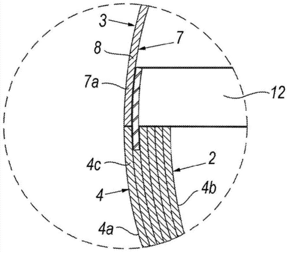 Orthotopic artificial bladder endoprosthesis