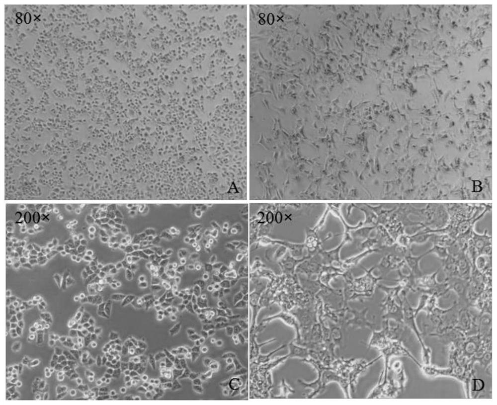 A method for preparing gemcitabine drug-resistant cell line of human gallbladder cancer