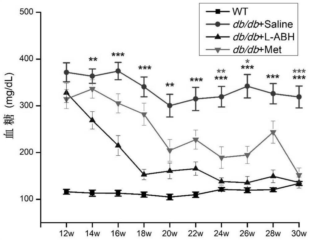 Application of L-aspartic acid-beta-hydroxamate in preparation of medicine for treating type 2 diabetes