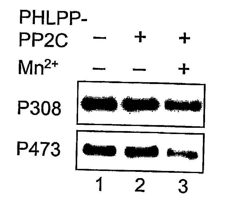 Compositions and Methods for Treating Diseases Associated With Phlpp
