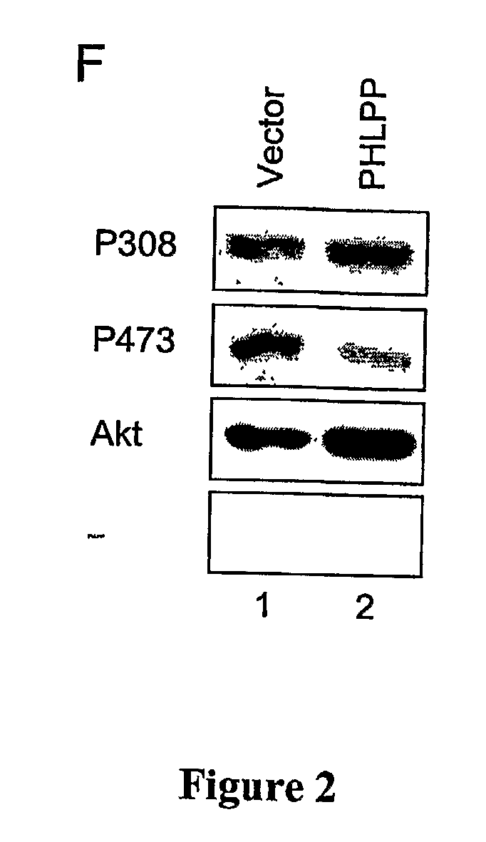 Compositions and Methods for Treating Diseases Associated With Phlpp