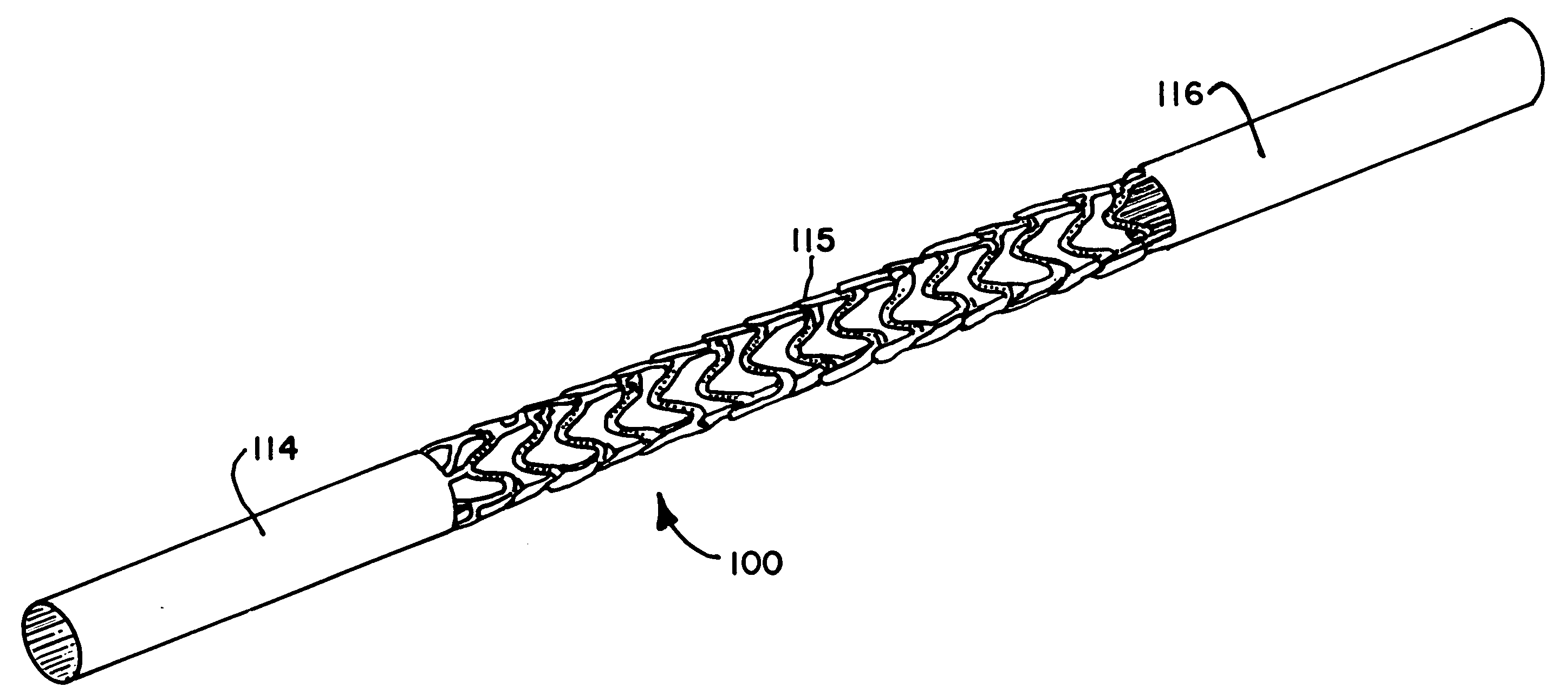Pitted metallic implants and method of manufacturing thereof