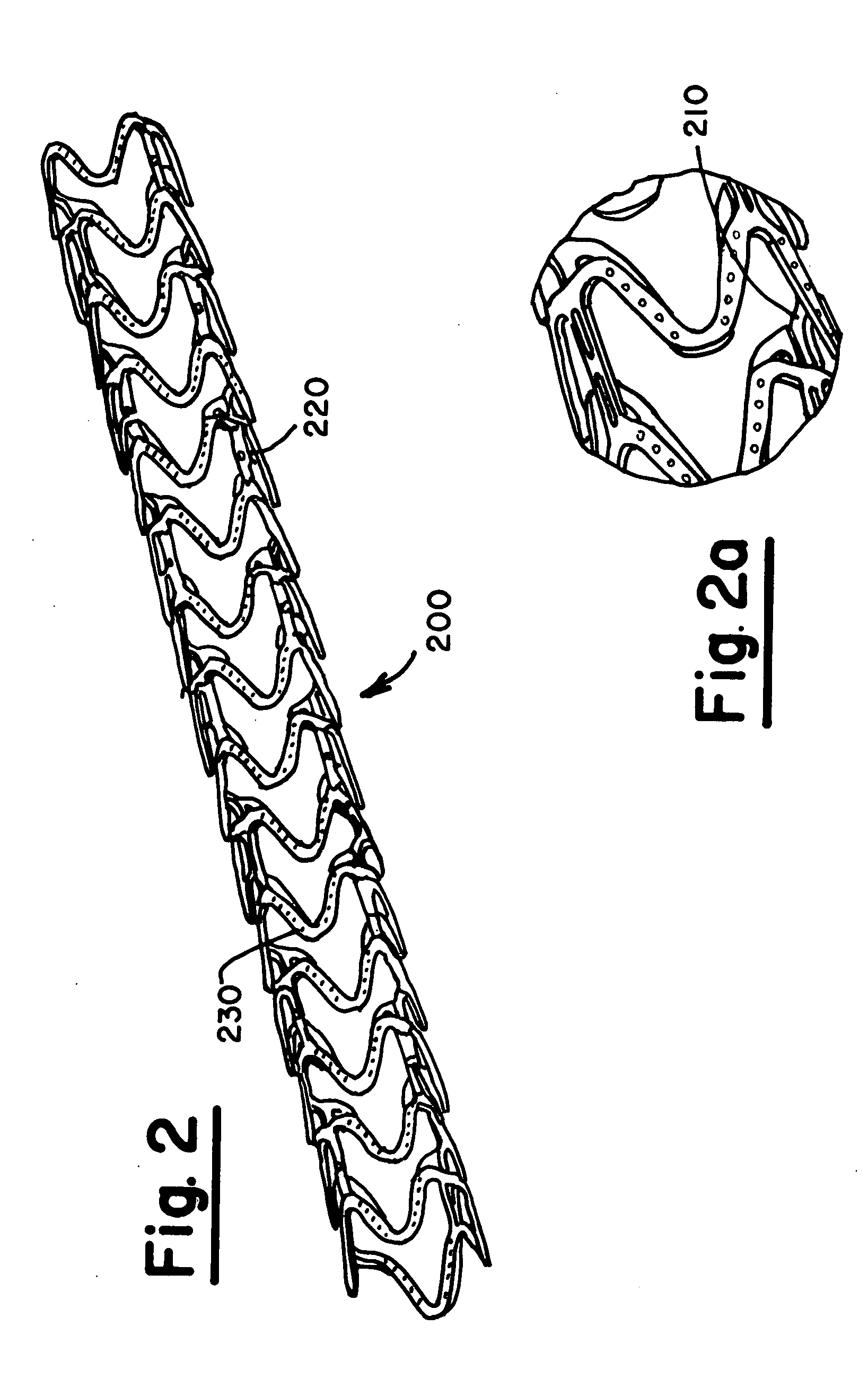 Pitted metallic implants and method of manufacturing thereof