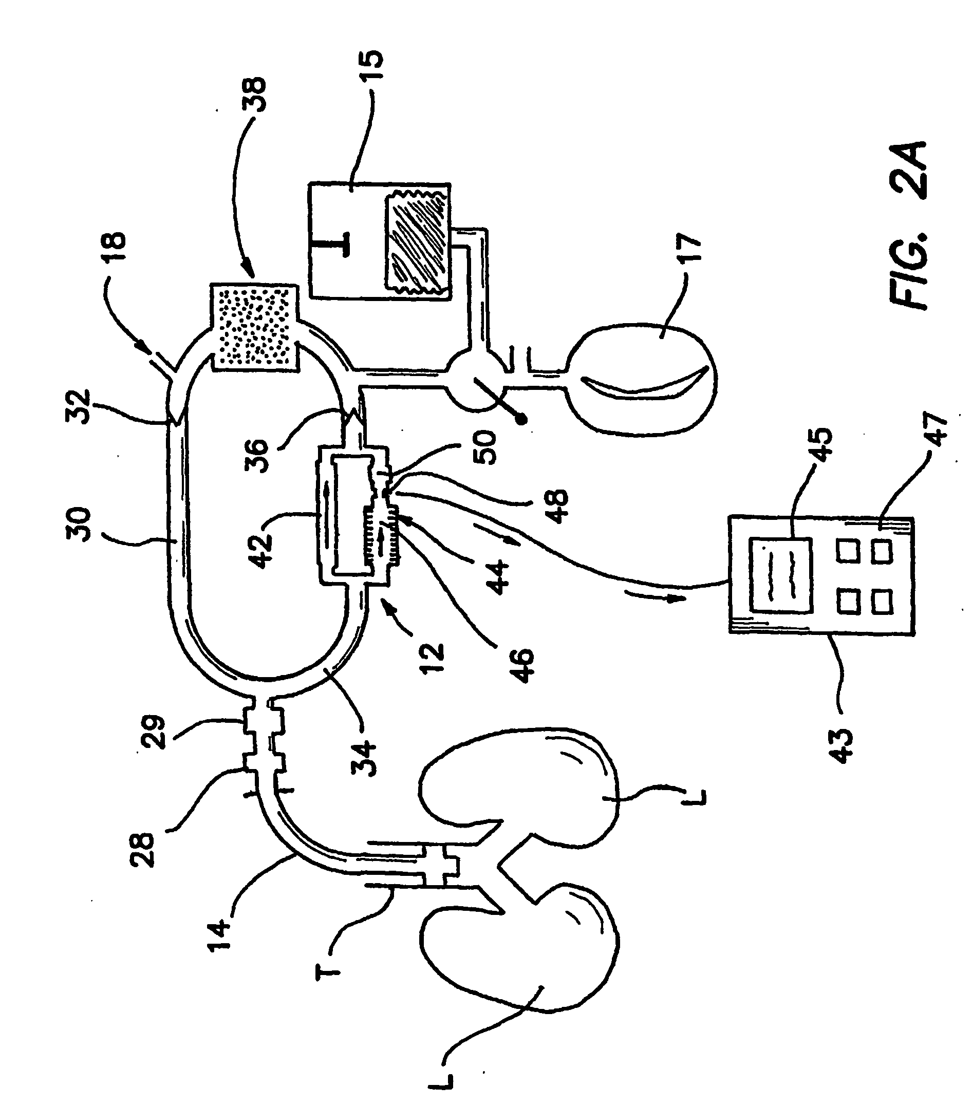 Bymixer apparatus and method for fast-response, adjustable measurement of mixed gas fractions in ventilation circuits