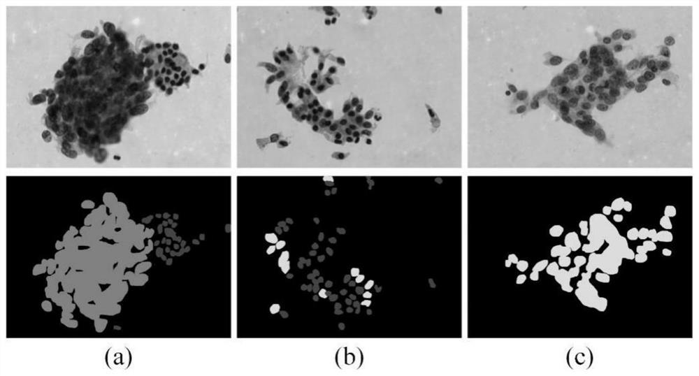 Lung brush film cell identification and segmentation method based on deep learning