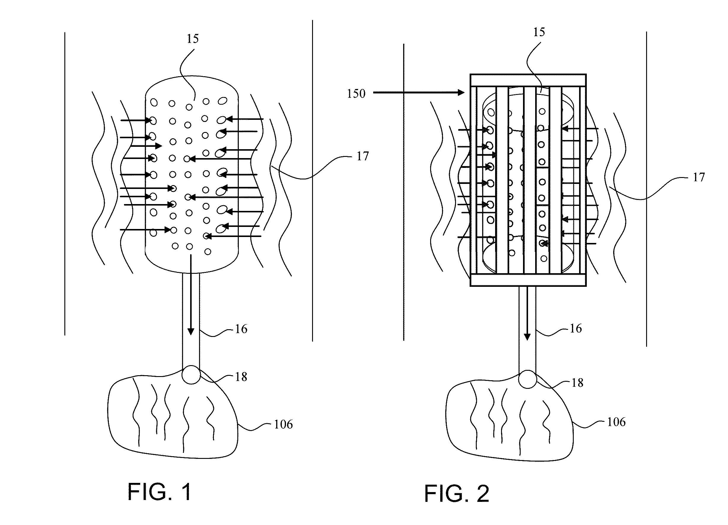 Blood filtering device and method