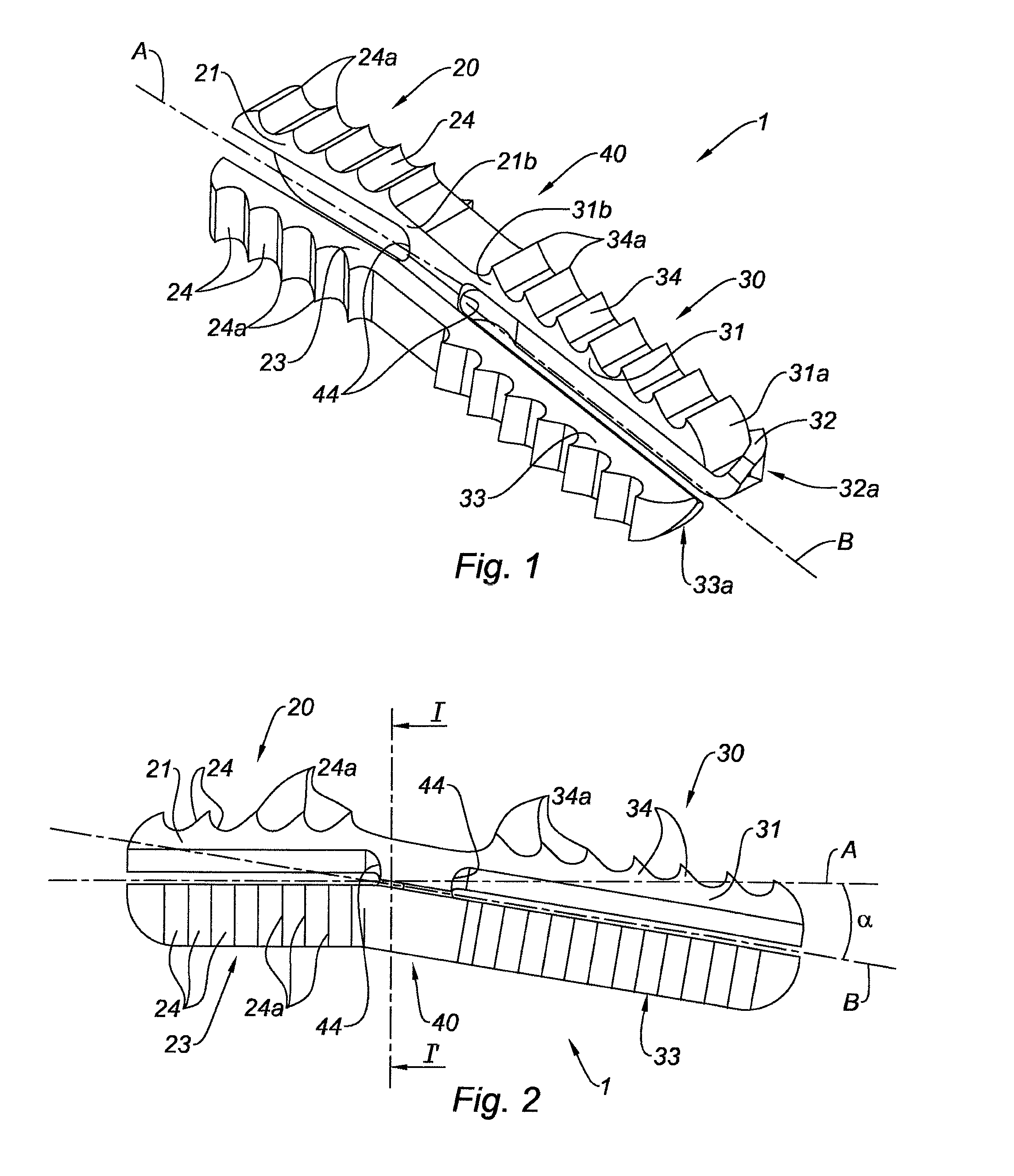 Arthrodesis implant