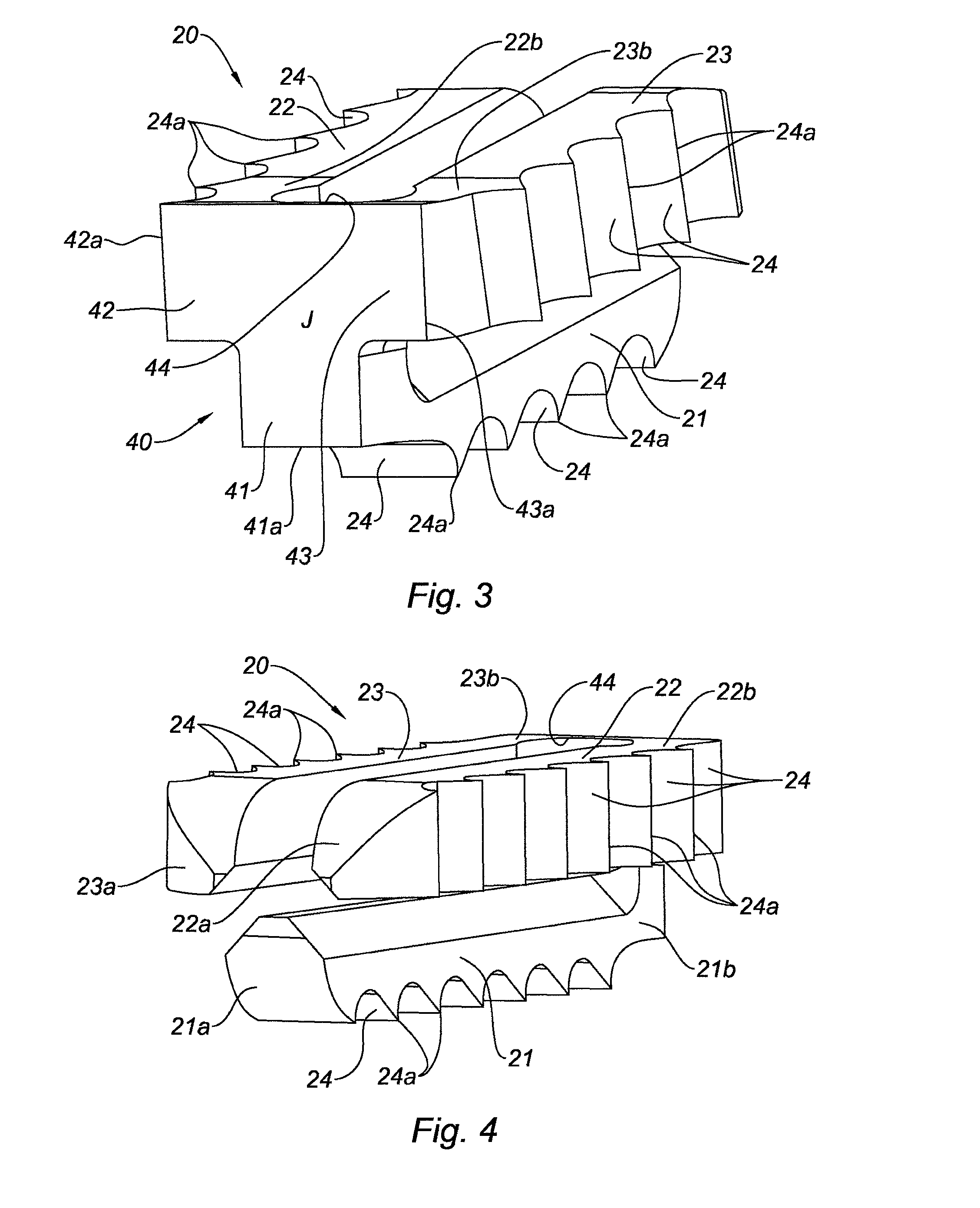 Arthrodesis implant