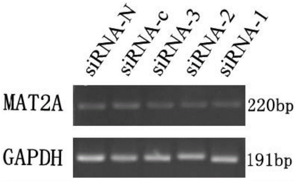 siRNA capable of inhibiting MAT2A genetic expression and application of siRNA