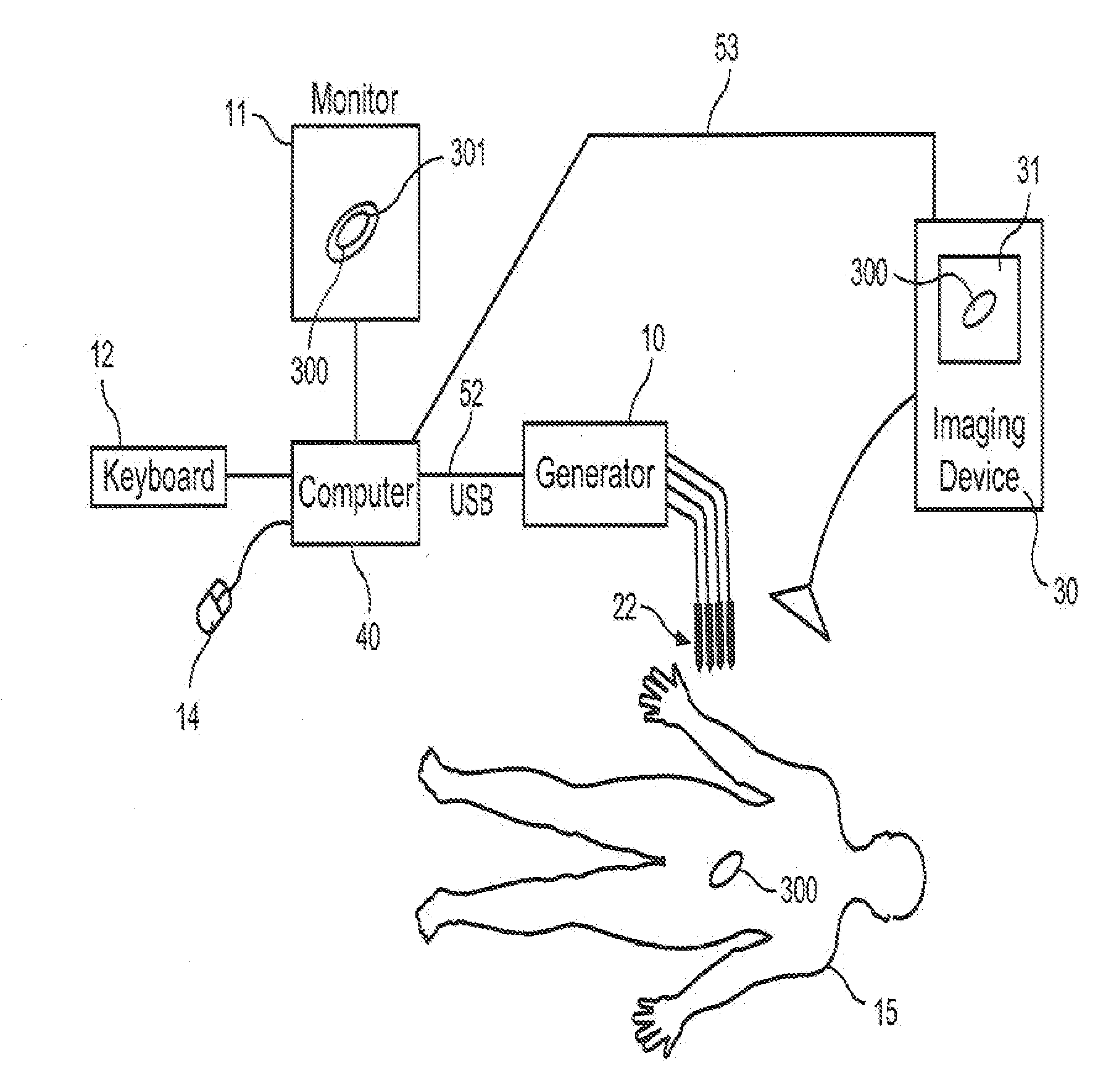 System and Method for Increasing a Target Zone for Electrical Ablation