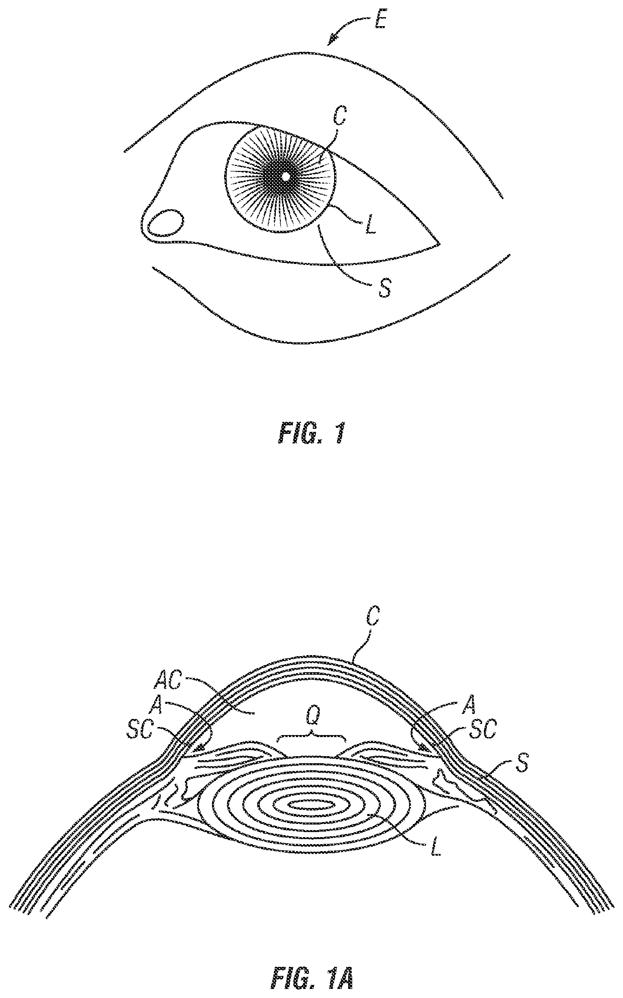 Devices and methods for treating aqueous collector channels of an eye to reduce intraocular pressure