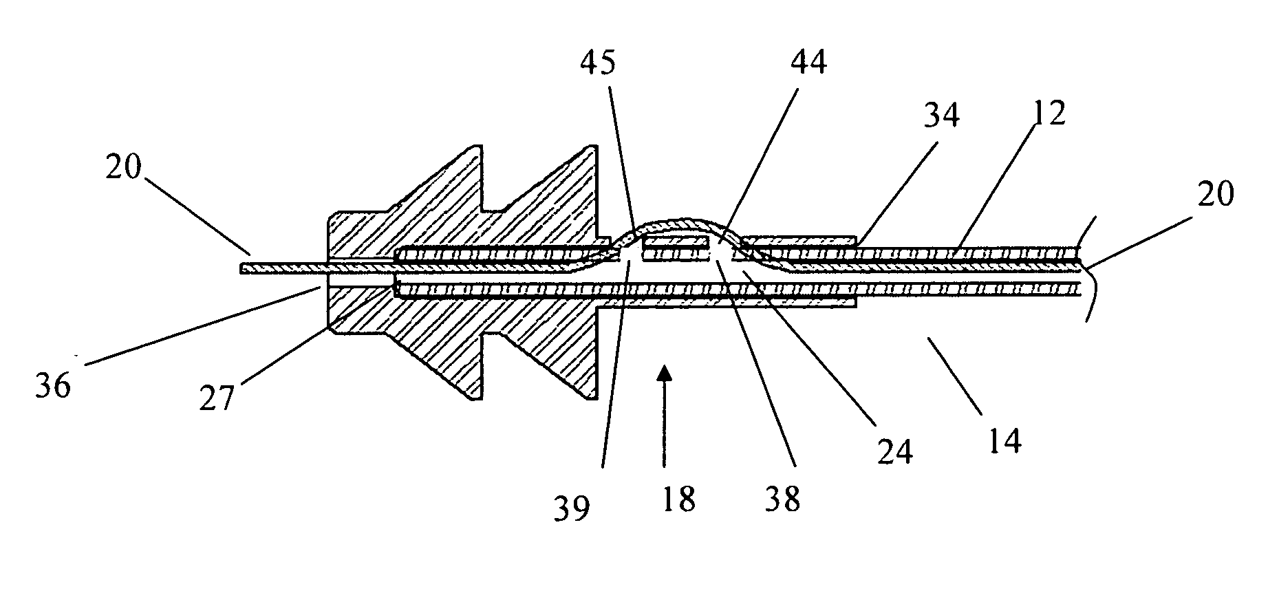 Insertion facilitation device for catheters