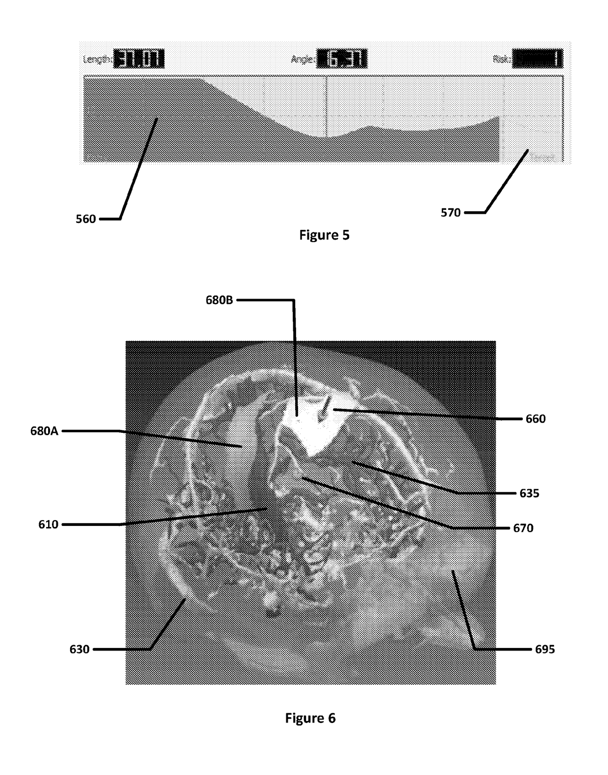 System and method for computer-assisted planning of a trajectory for a surgical insertion into a skull