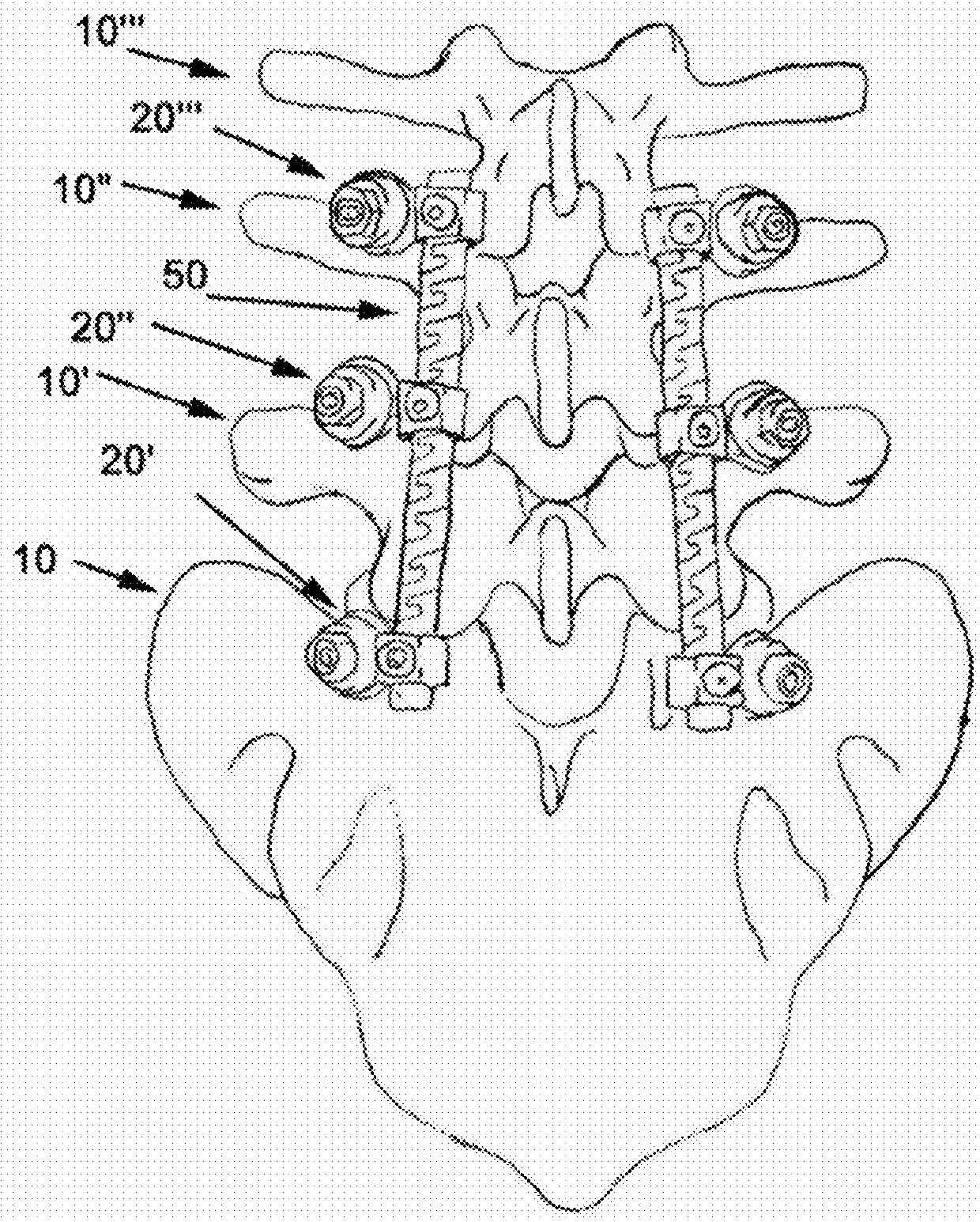 Flexible Spine Components