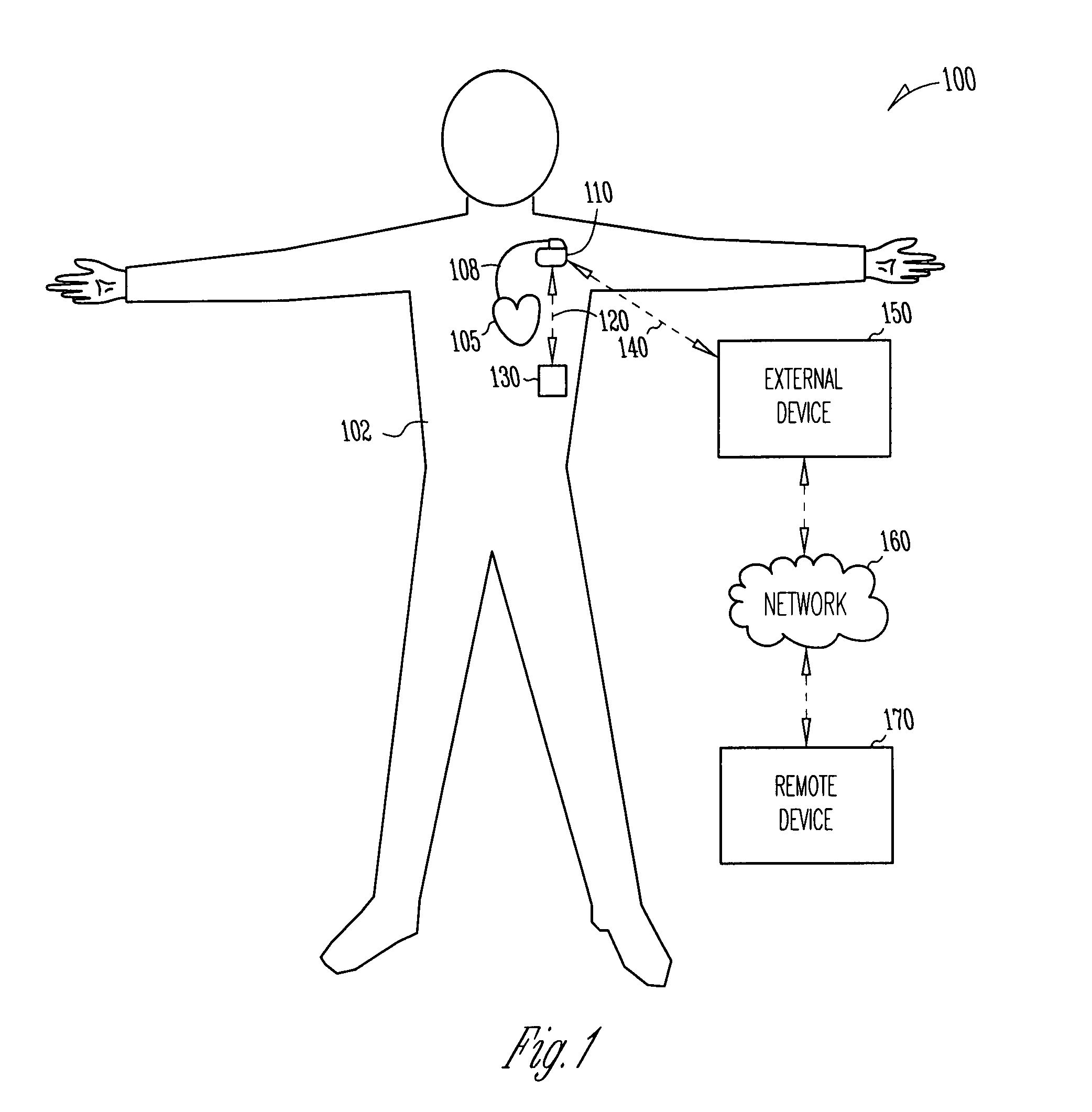Method and apparatus for modulating cellular metabolism during post-ischemia or heart failure