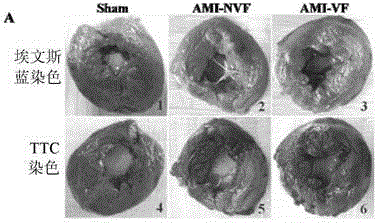 Circulating miRNAs (microRNAs) for early diagnosis of acute coronary syndromes and application thereof