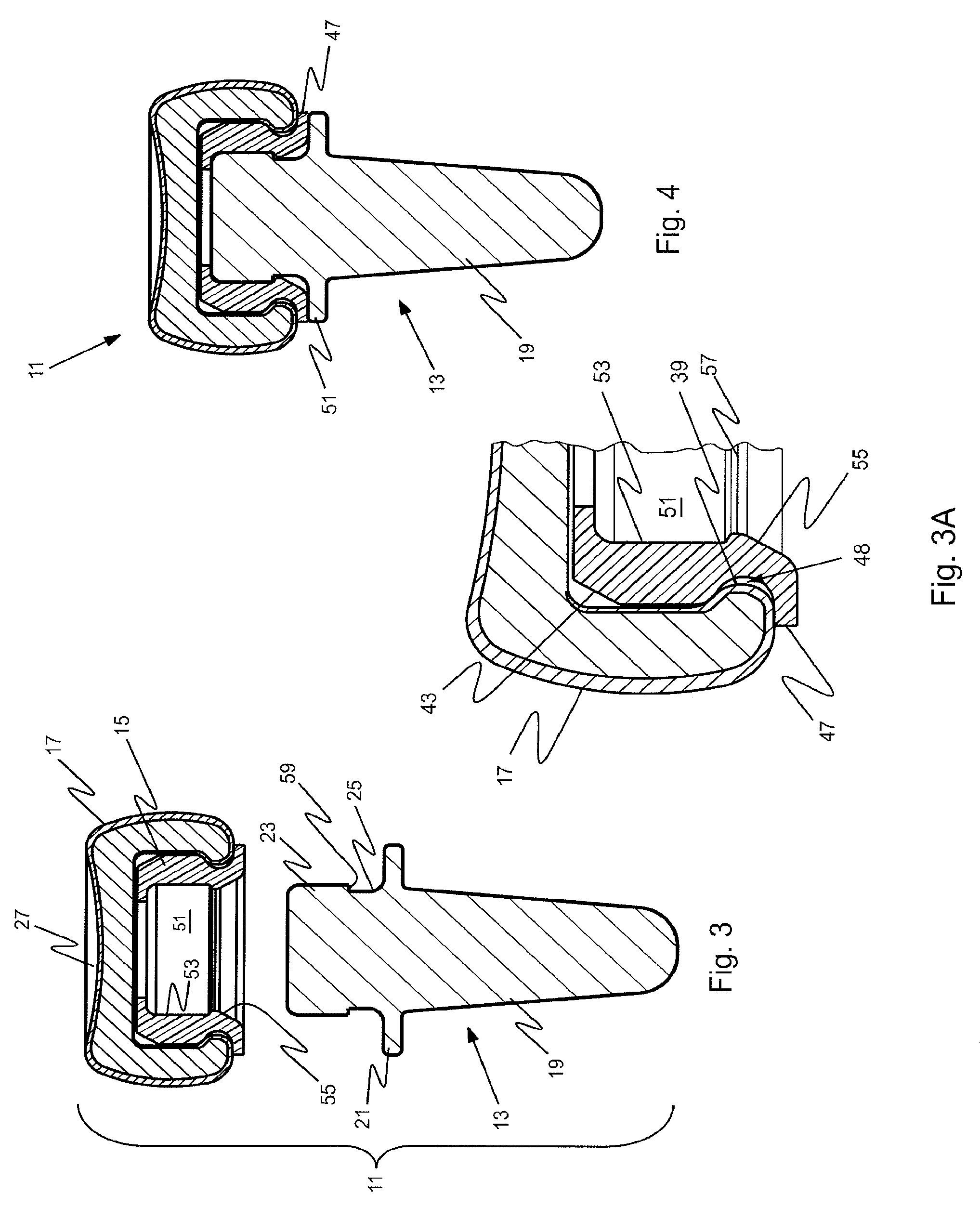 Prosthetic implant and assembly method