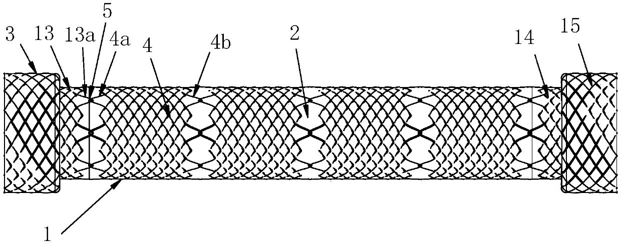 A super-compliant segmented stent and its weaving method