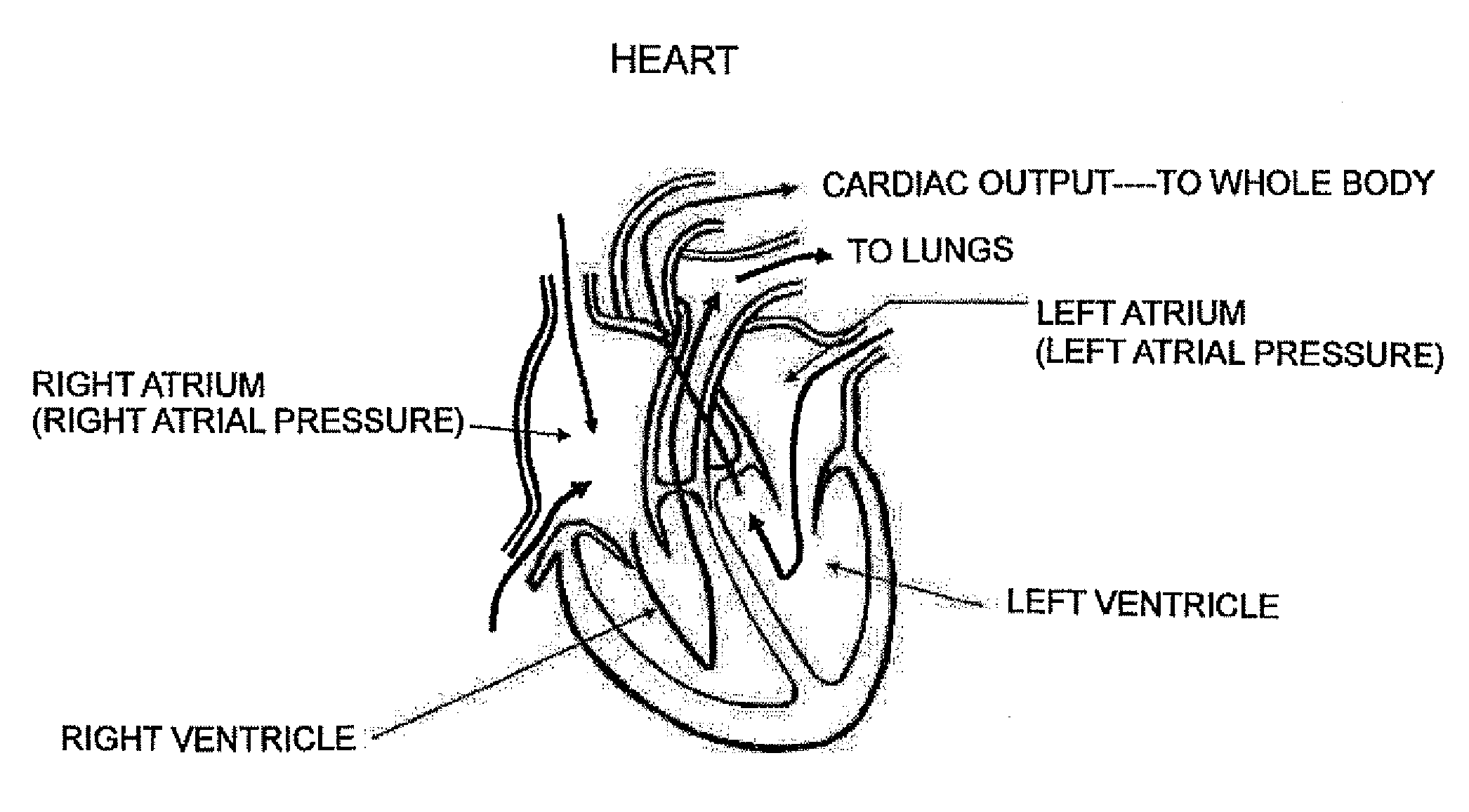 Cardiac Disease Treatment System