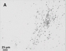 Pharmaceutical composition for treating traumatic craniocerebral trauma and preparation method of pharmaceutical composition