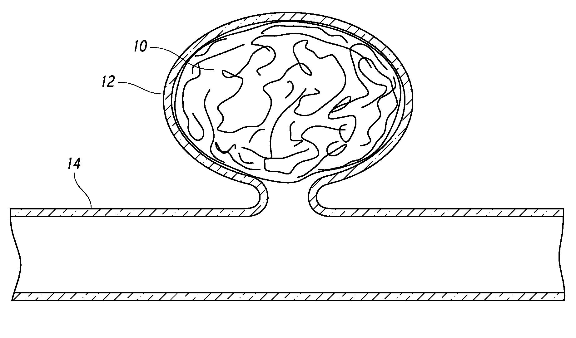 Occlusive devices